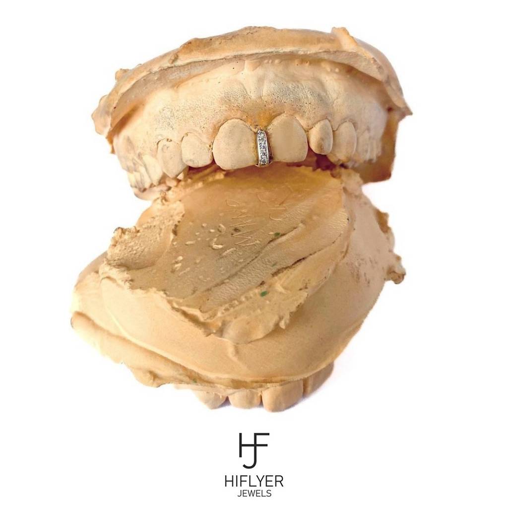 Subtle Ice Grillz- Natural Diamonds : HFJGrillz4