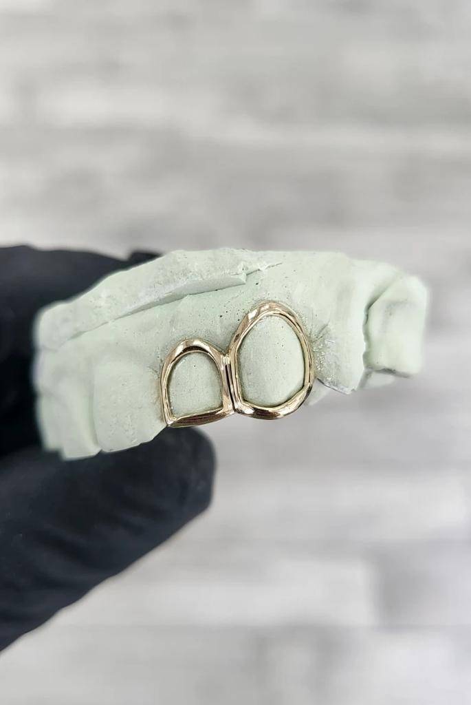 Duo Classic Openwork Grillz : HFJGrillz3