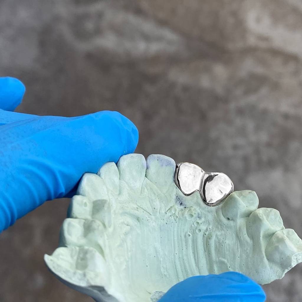 Twin Metallic Grillz : HFJGrillz2