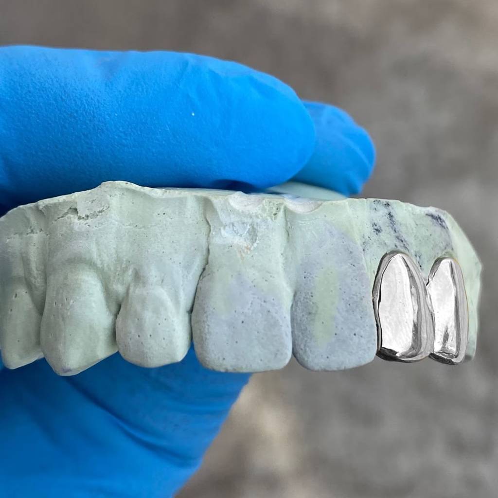 Twin Metallic Grillz : HFJGrillz2