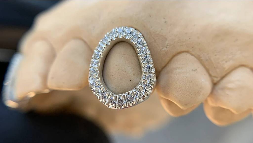 Iced Out Openwork Grillz (1 Cap) : HFJGrillz1