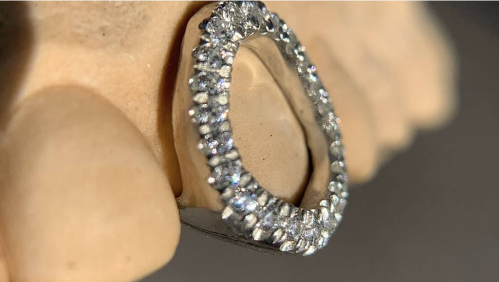 Iced Out Openwork Grillz (1 Cap) : HFJGrillz1